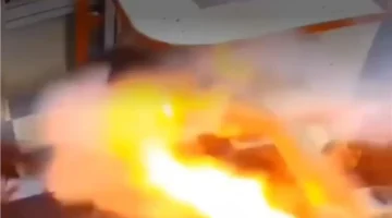 صادم وغير متوقع.. انفجار بطارية هاتف يصيب طفلًا بجروح داخل فمه